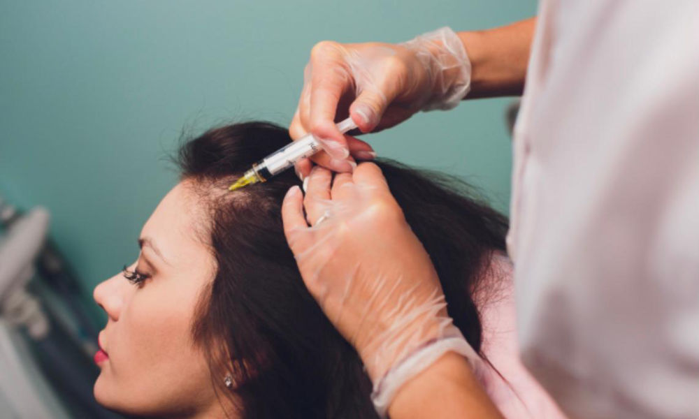PRP Treatment Sydney 3 Female PRP hair loss treatment injection