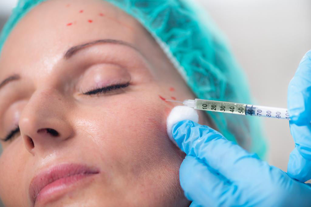 PRP Skin Treatment injection in face