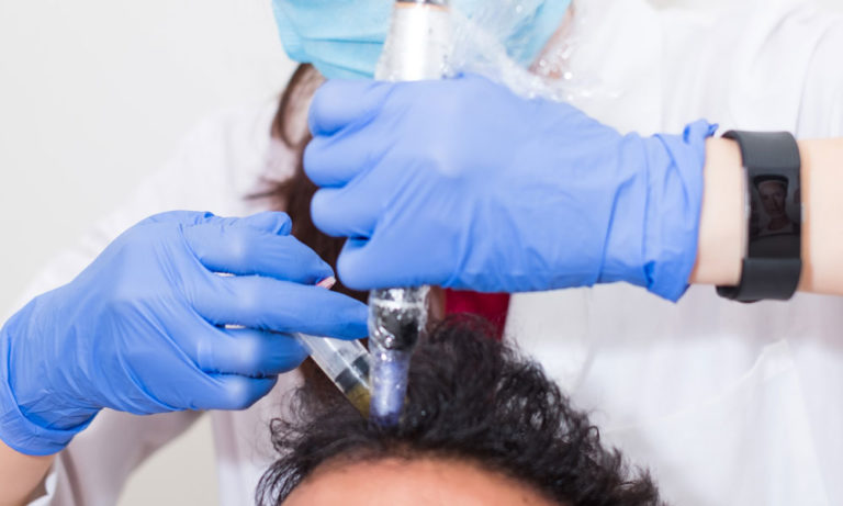 Home 4 Men-PRP-hair-treatment-