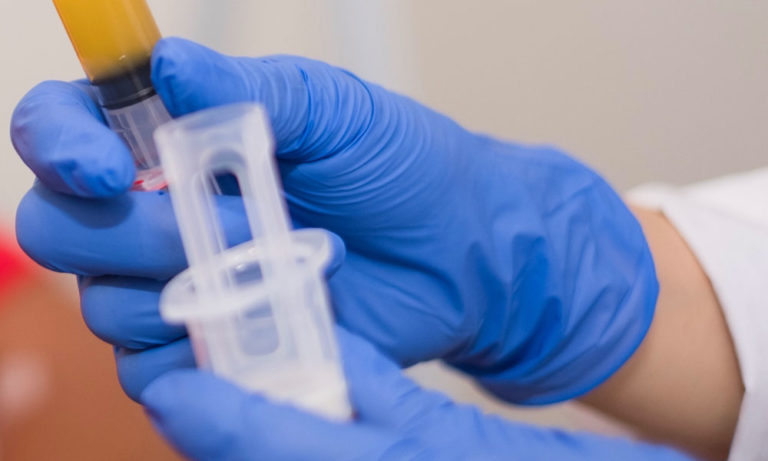 Home 5 PRP-hair-loss-treatment