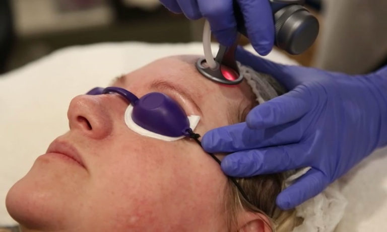 Home 7 CO2-Fractional-Laser