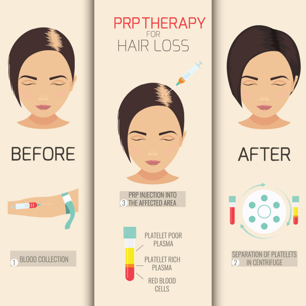 Hair Loss How To Stop And Reverse Hair Loss Thinning