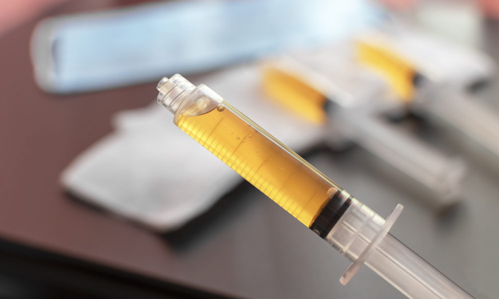 PRP Hand Rejuvenation 1 Blood plasma in a syringe on a blurred background