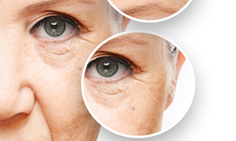 Home 15 Fine Lines & Wrinkles