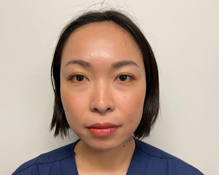 PRP Treatment Melbourne 15 Staff Photo - Naoka Kojo