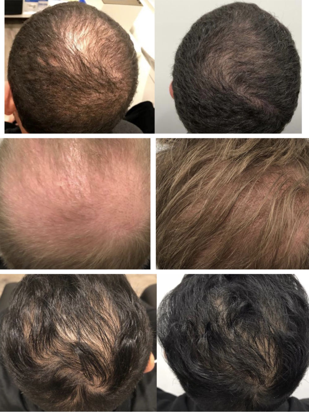 Before & Afters - Hair & Skin Science