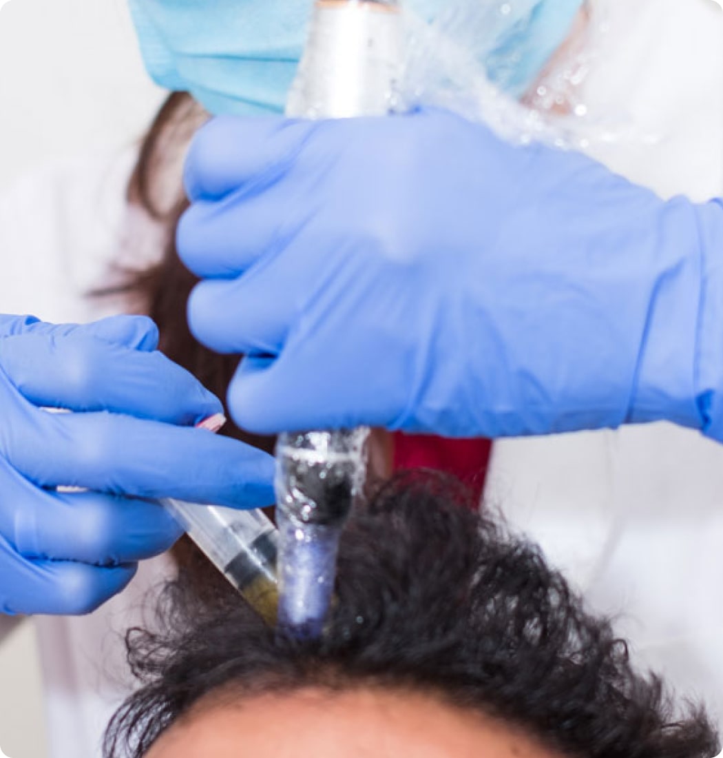 Chatswood PRP Hair Clinic | Hair Loss Treatment | Hair & Skin Science
