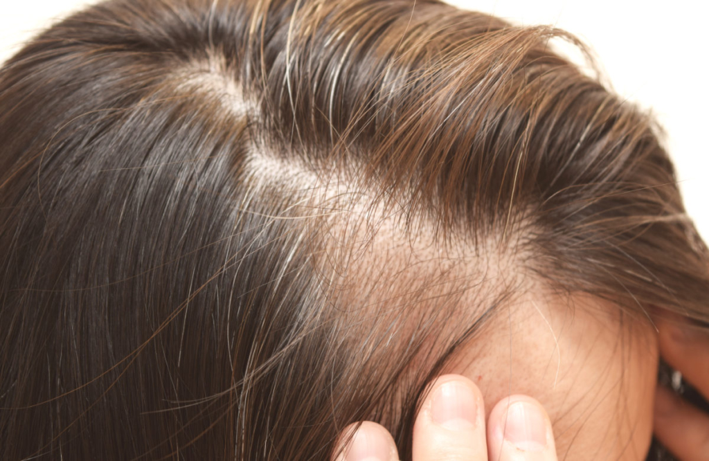 What to look for in a hair doctor? 2 What to look for in a hair doctor? 2